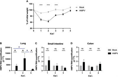 Human metapneumovirus respiratory infection affects both innate and adaptive intestinal immunity